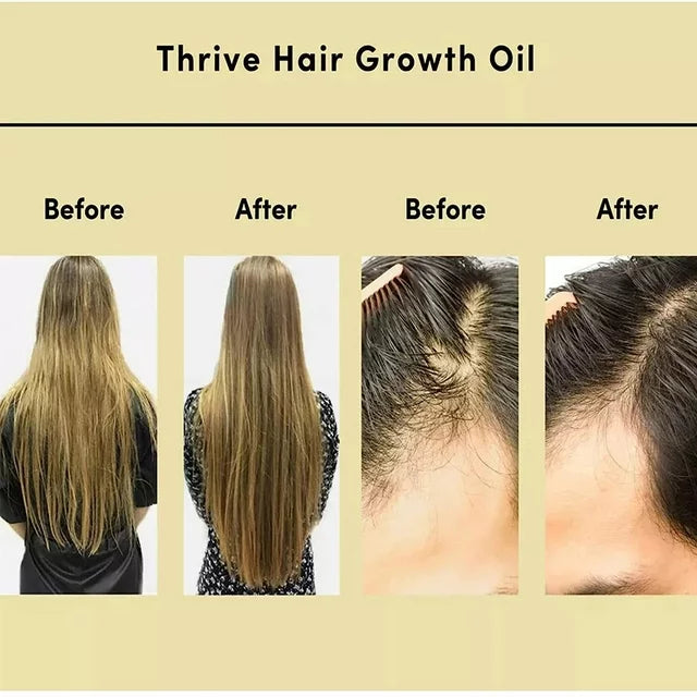 RevitaRoots™ Natural Hair Growth Oil