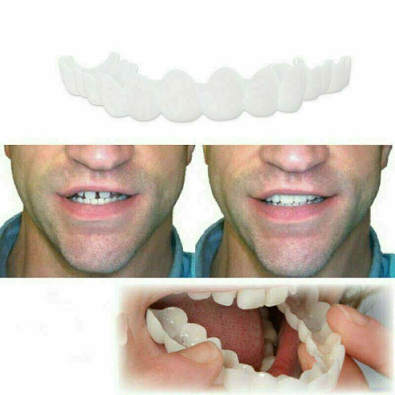 Smile Instant Snap On Veneers Fake Teeth for Upper & Lower