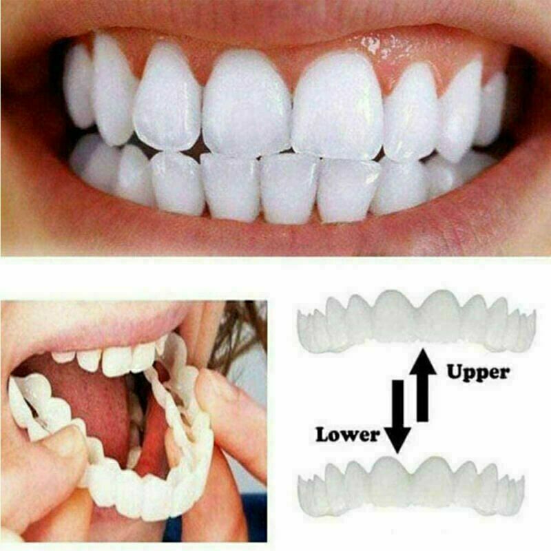 Smile Instant Snap On Veneers Fake Teeth for Upper & Lower